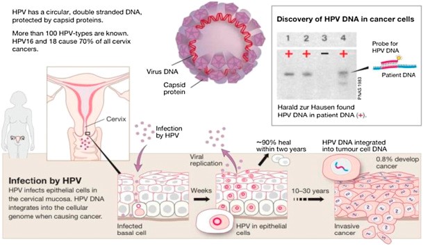 غربالگری ویروس HPV راهکاری نوین جهت پیشگیری از سرطان رحم